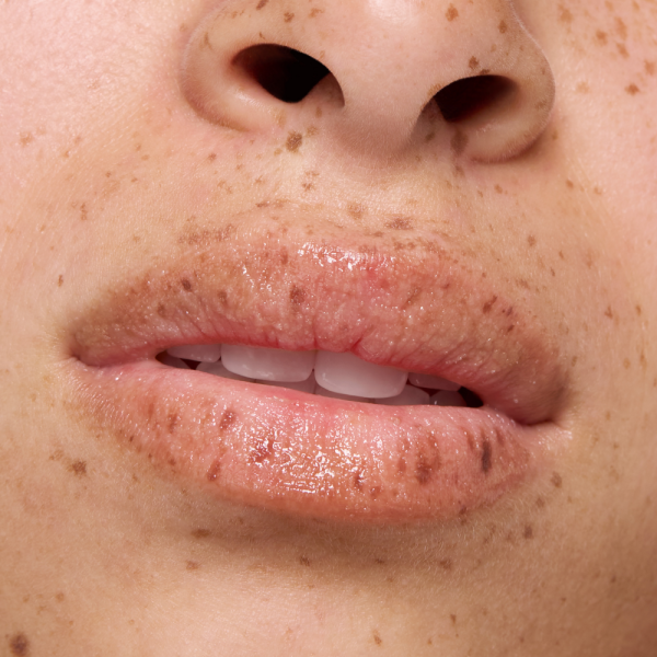 lip care SUGAR SCRUB - Image 8